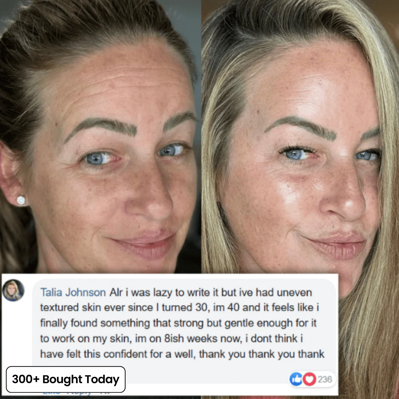 Collagen balm customer review image