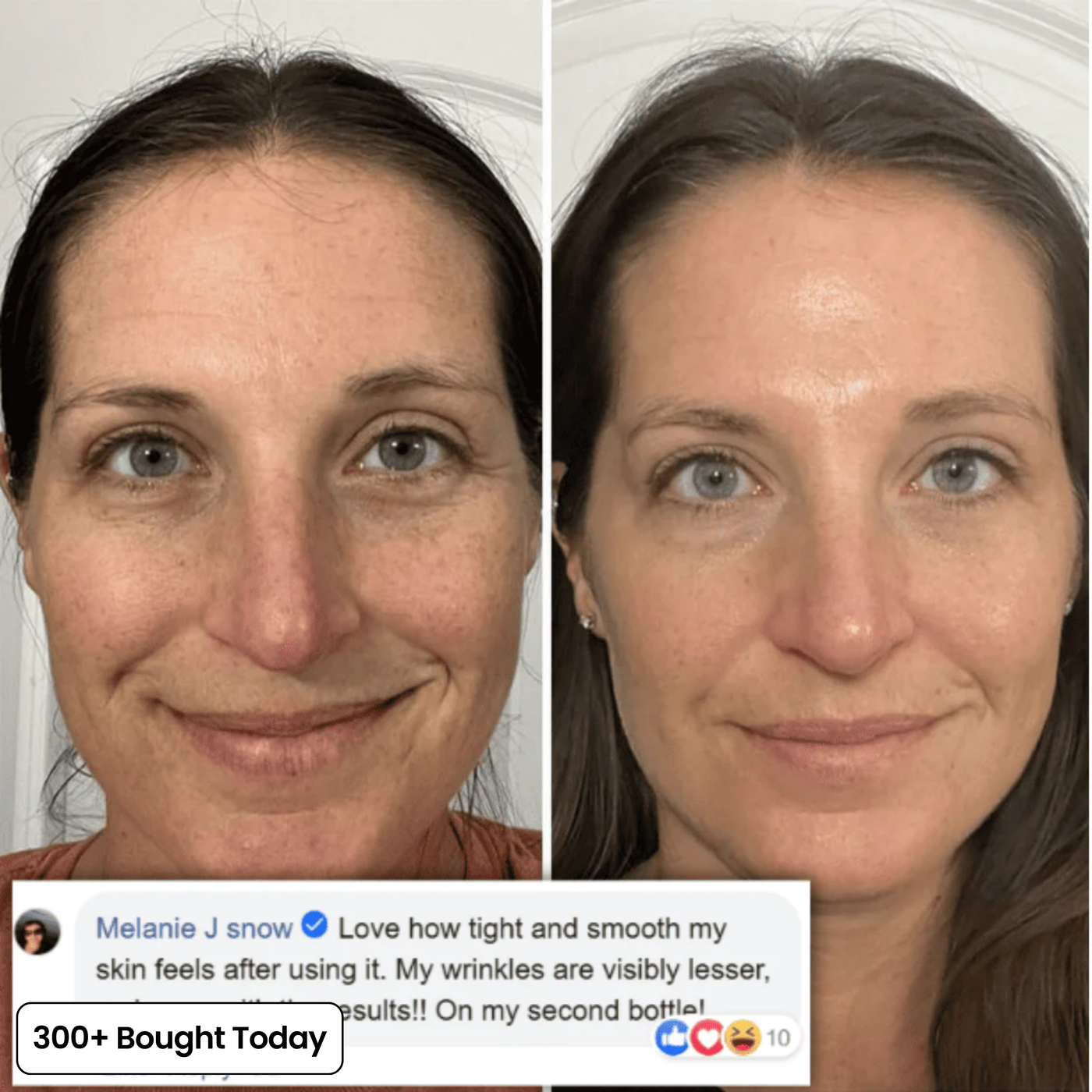 Collagen balm customer review image